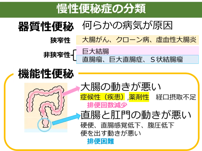便秘とその治療薬