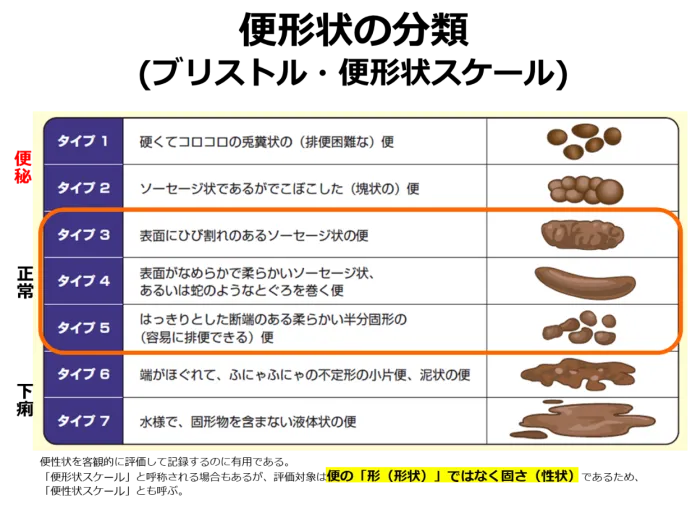 便秘とその治療薬