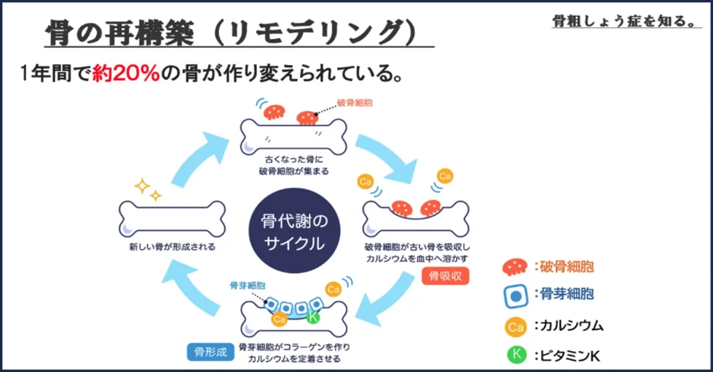骨粗しょう症について