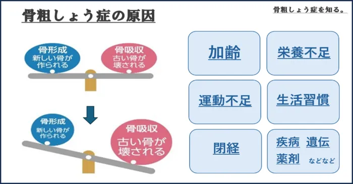 骨粗しょう症について